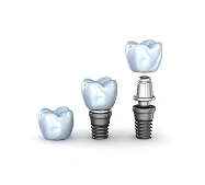 Dental implants and crowns displayed for tooth replacement and restorative dentistry