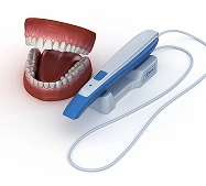 Digital intraoral scanner for capturing accurate dental impressions