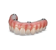 Full arch denture designed to restore missing teeth and oral function