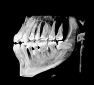 X-Ray-Capital-Equipment-and-AI